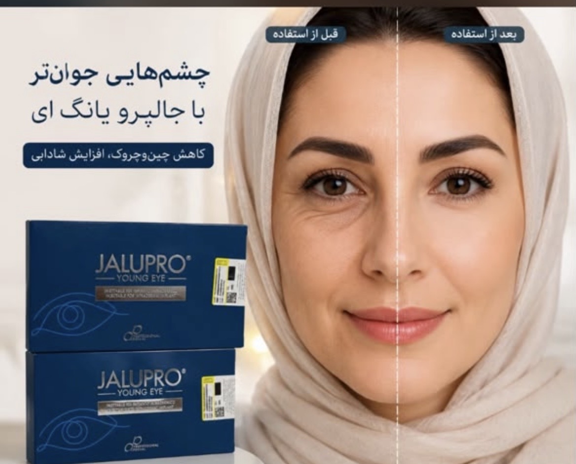 مزوژل جالپرو یانگ آی